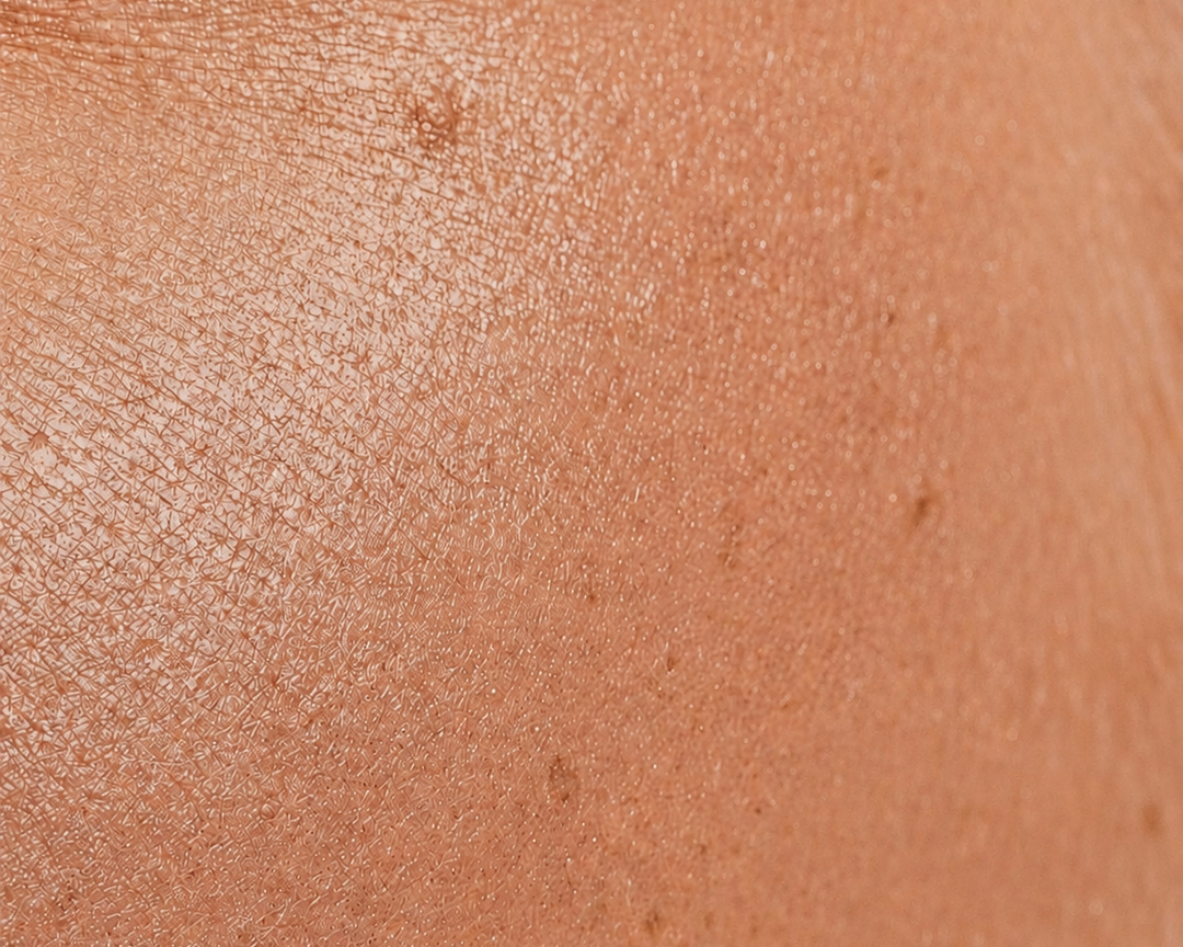 Melanin vs. Lipofuscin: What’s the Difference?